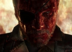 Metal Gear Solid V's New Gameplay Trailer Is Bloody Good