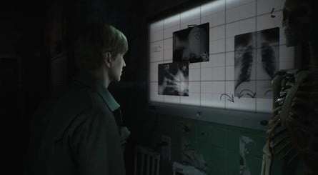 Silent Hill 2 Remake Screenshot 2