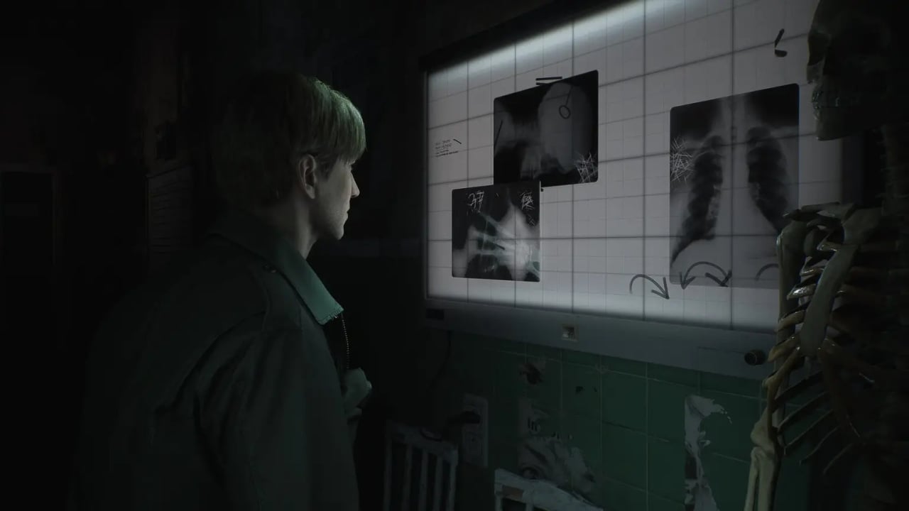 Silent Hill 2 Remake Features an Over-the-Shoulder Camera, Exclusive to PS5  and PC for 12 Months – Rumour